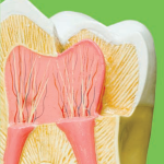 Root Canal Therapy